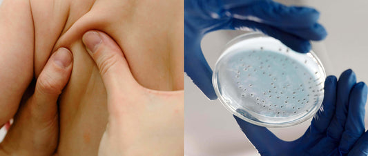 Neurodermite nei bambini: i probiotici possono essere d’aiuto?